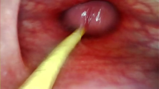 EXTREME ANAL SELF PERSPECTIVE. ONLINE CAMERA INSIDE HER ANUS AS I POUND HER WITH MY HUGE PENIS AND JIZZ DEEP INSIDE