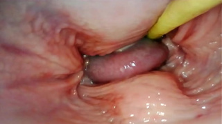 AMAZING INTERNAL SELF PERSPECTIVE. WEBCAM INSIDE HER SNATCH WHILE I FILL HER WITH SPERM