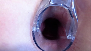 Stretching the anal and snatch with a gynecological speculum. MILF with a large ass and a gaping ass-hole and a gaping snatch.