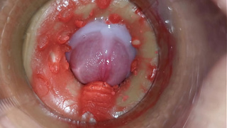 Online cam Inside Deep Vagina Captures Gigantic Ejaculation of Jizz 4k